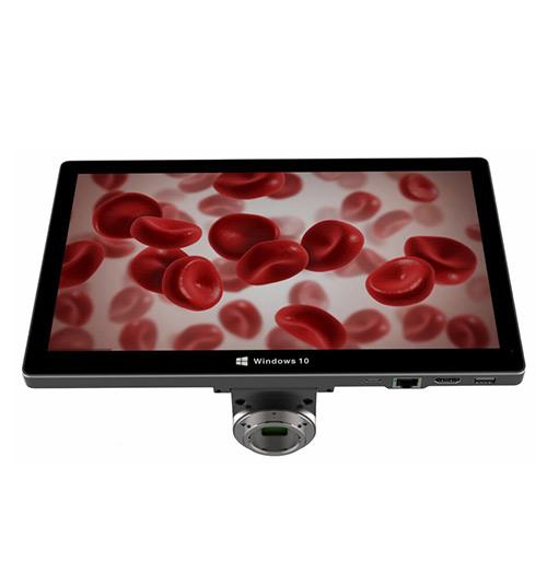 universal digital lcd with camera for microscopes